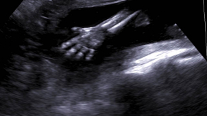 Do Olomouce se sjeli gynekologové z celé republiky